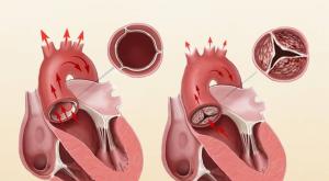 Закономерности изменений показателей ультразвукового исследования при врожденных пороках сердца у плода в зависимости от особенностей внутрисердечной гемодинамики антенатального периода